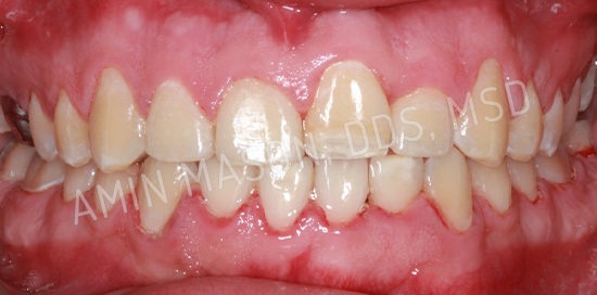 Comprehensive Braces Case after