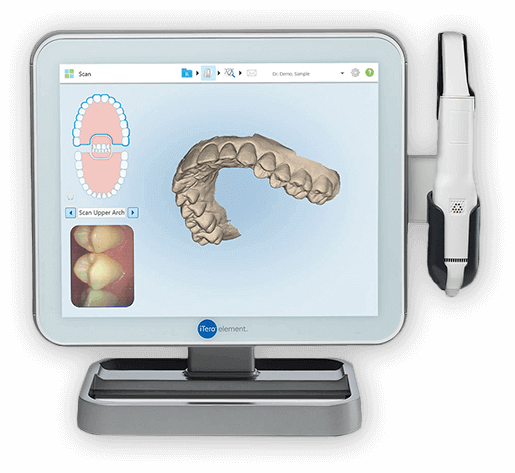 Smile design from iTero scanner on computer