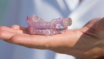 Custom crafted occlusal splint for TMJ