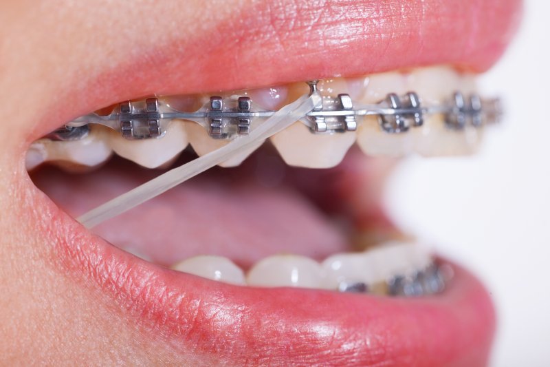 klowen braces columbus KLOW 80mg (Advanced Bio-Regenerative Quad-Matrix) main image 1