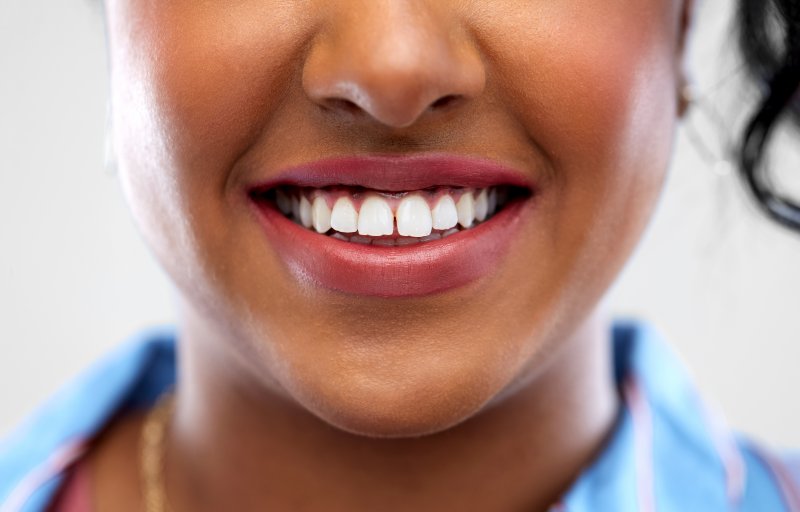 a woman with a gap between her two front teeth